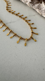 Karner Anklet
